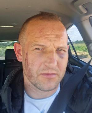 [VIDEO] Rutkowski na tropie byłych policjantów. Dariusz  Albrychowicz twierdzi, że został brutalnie pobity 